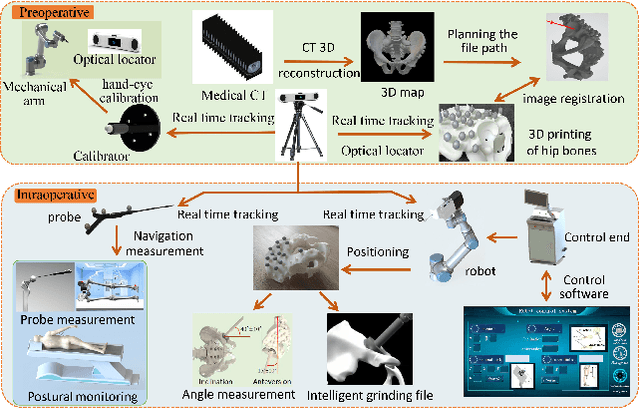 Figure 1 for A total hip surgery robot system based on intelligent positioning and optical measurement