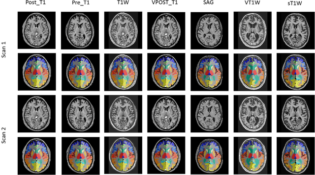 Figure 1 for Reproducibility Evaluation of SLANT Whole Brain Segmentation Across Clinical Magnetic Resonance Imaging Protocols