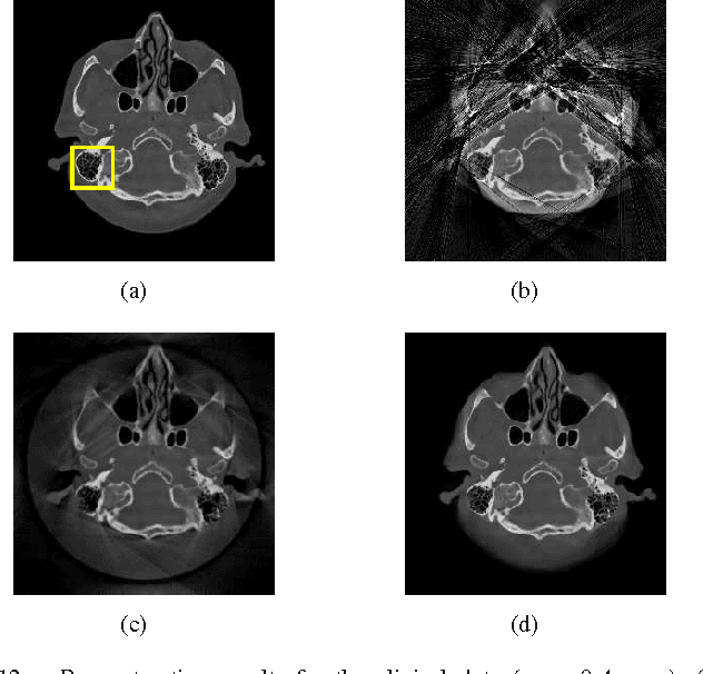 Figure 4 for Mixed one-bit compressive sensing with applications to overexposure correction for CT reconstruction