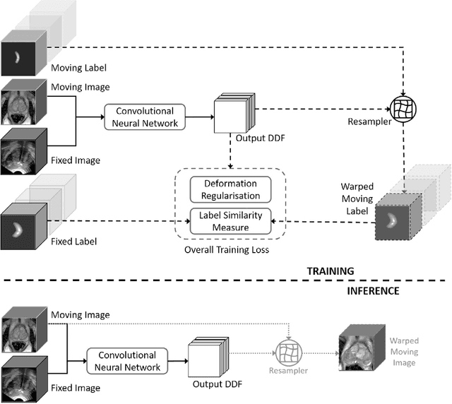 Figure 3 for Weakly-Supervised Convolutional Neural Networks for Multimodal Image Registration