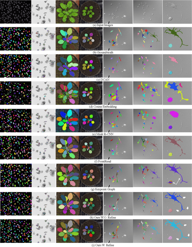 Figure 4 for Object-Guided Instance Segmentation With Auxiliary Feature Refinement for Biological Images