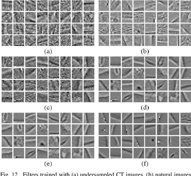 Figure 4 for Convolutional Sparse Coding for Compressed Sensing CT Reconstruction