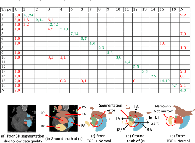 Figure 3 for ImageCHD: A 3D Computed Tomography Image Dataset for Classification of Congenital Heart Disease
