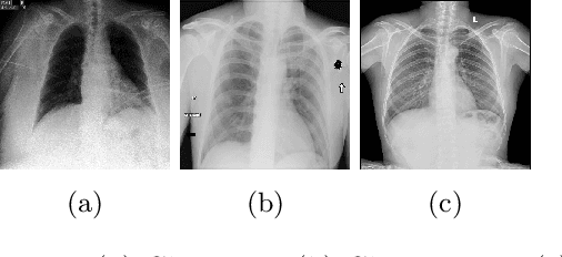 Figure 3 for Federated Contrastive Learning for Decentralized Unlabeled Medical Images