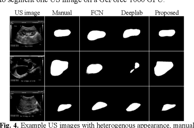 Figure 4 for Fully-automatic segmentation of kidneys in clinical ultrasound images using a boundary distance regression network
