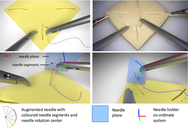 Figure 3 for Towards Augmented Reality-based Suturing in Monocular Laparoscopic Training