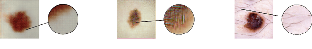 Figure 4 for Generating Highly Realistic Images of Skin Lesions with GANs