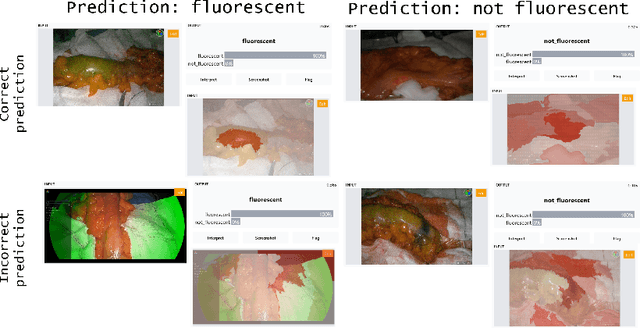 Figure 4 for Fluorescence angiography classification in colorectal surgery -- A preliminary report