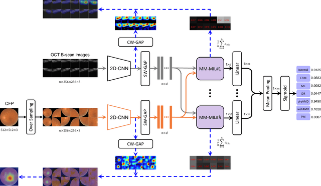 Figure 2 for Multi-Modal Multi-Instance Learning for Retinal Disease Recognition