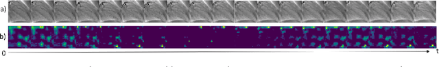 Figure 4 for Repetitive Motion Estimation Network: Recover cardiac and respiratory signal from thoracic imaging