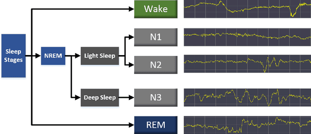 Figure 1 for Sleep Staging Based on Multi Scale Dual Attention Network