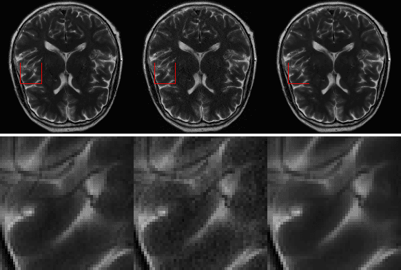 Figure 3 for GRAPPA-GANs for Parallel MRI Reconstruction