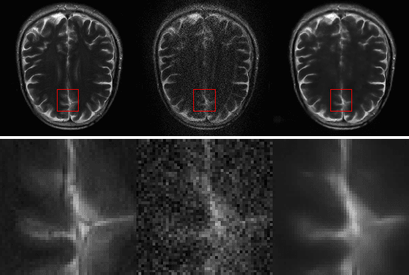 Figure 4 for GRAPPA-GANs for Parallel MRI Reconstruction