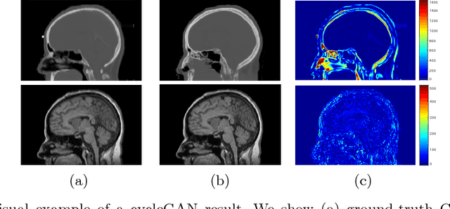 Figure 1 for Unpaired Brain MR-to-CT Synthesis using a Structure-Constrained CycleGAN