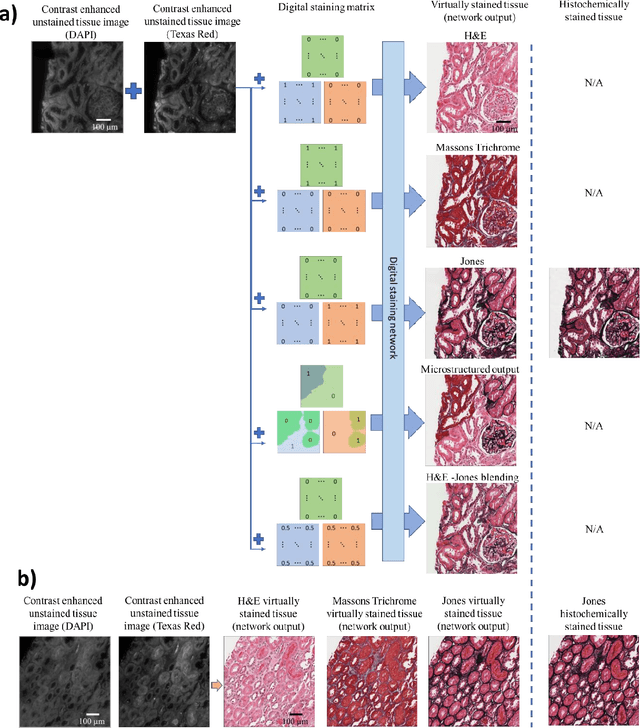 Figure 2 for Digital synthesis of histological stains using micro-structured and multiplexed virtual staining of label-free tissue