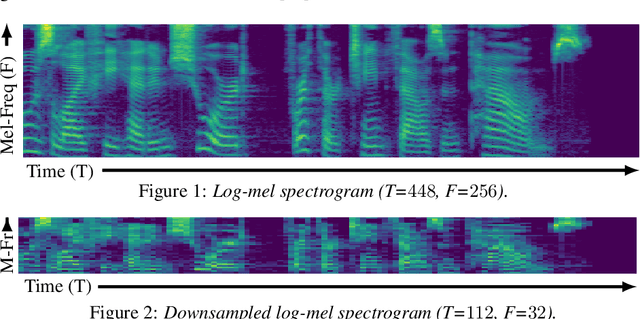 Figure 1 for R-MelNet: Reduced Mel-Spectral Modeling for Neural TTS