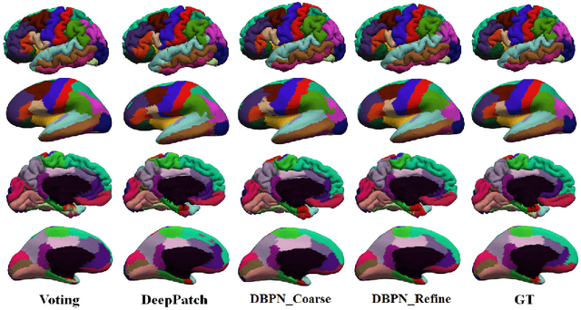 Figure 3 for Geometric Brain Surface Network For Brain Cortical Parcellation