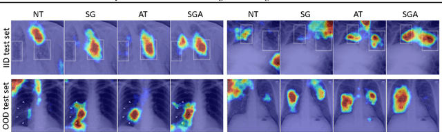 Figure 3 for Saliency Guided Adversarial Training for Learning Generalizable Features with Applications to Medical Imaging Classification System