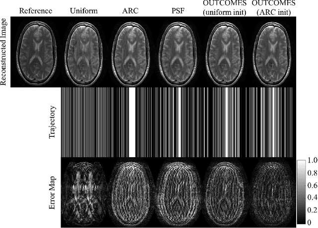 Figure 3 for OUTCOMES: Rapid Under-sampling Optimization achieves up to 50% improvements in reconstruction accuracy for multi-contrast MRI sequences