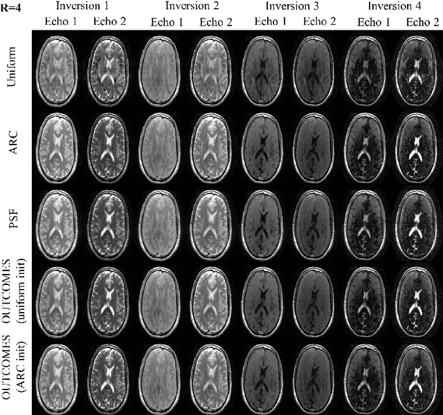 Figure 4 for OUTCOMES: Rapid Under-sampling Optimization achieves up to 50% improvements in reconstruction accuracy for multi-contrast MRI sequences