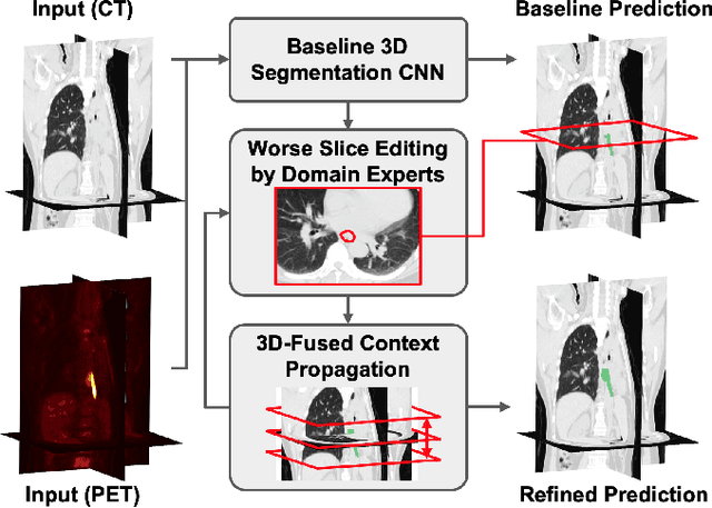 Figure 1 for Interactive Radiotherapy Target Delineation with 3D-Fused Context Propagation