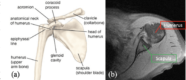 Figure 1 for Recursive 3D Segmentation of Shoulder Joint with Coarse-scanned MR Image