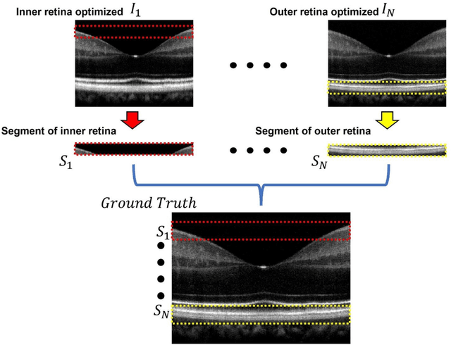 Figure 2 for ADC-Net: An Open-Source Deep Learning Network for Automated Dispersion Compensation in Optical Coherence Tomography