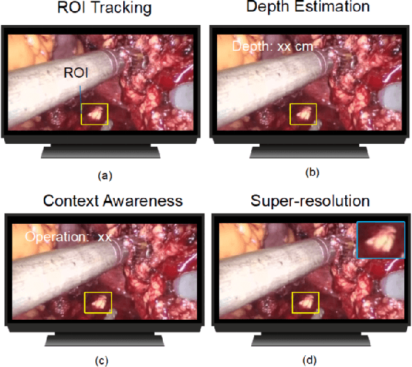 Figure 1 for Real-time Surgical Environment Enhancement for Robot-Assisted Minimally Invasive Surgery Based on Super-Resolution