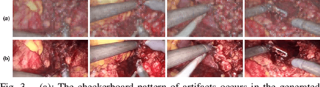 Figure 3 for Real-time Surgical Environment Enhancement for Robot-Assisted Minimally Invasive Surgery Based on Super-Resolution