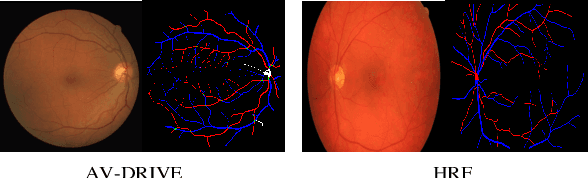 Figure 1 for Consistent Posterior Distributions under Vessel-Mixing: A Regularization for Cross-Domain Retinal Artery/Vein Classification