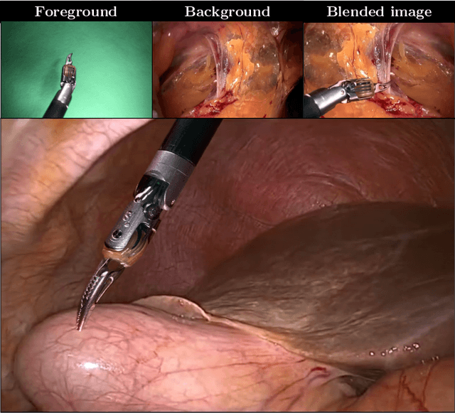 Figure 1 for Image Compositing for Segmentation of Surgical Tools without Manual Annotations
