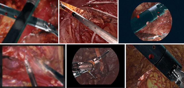 Figure 3 for Image Compositing for Segmentation of Surgical Tools without Manual Annotations