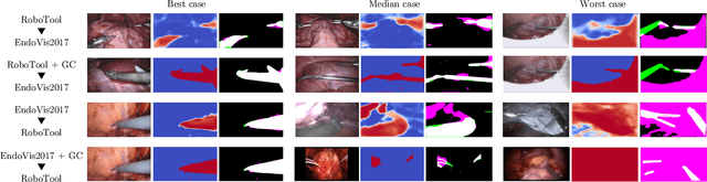 Figure 4 for Image Compositing for Segmentation of Surgical Tools without Manual Annotations