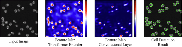 Figure 1 for CellCentroidFormer: Combining Self-attention and Convolution for Cell Detection