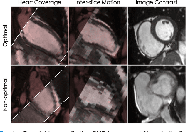 Figure 1 for Learning-Based Quality Control for Cardiac MR Images