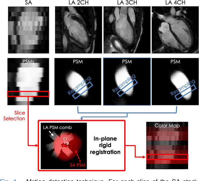 Figure 4 for Learning-Based Quality Control for Cardiac MR Images