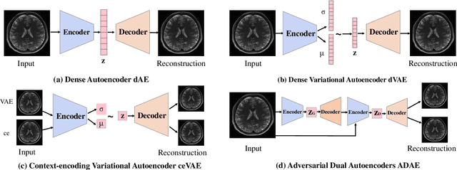 Figure 3 for Brain Tumor Anomaly Detection via Latent Regularized Adversarial Network
