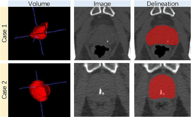Figure 1 for HF-UNet: Learning Hierarchically Inter-Task Relevance in Multi-Task U-Net for Accurate Prostate Segmentation