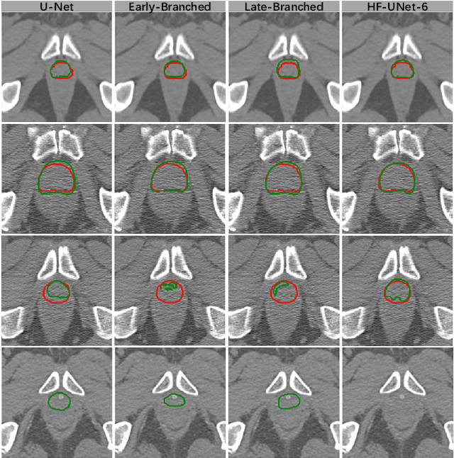 Figure 2 for HF-UNet: Learning Hierarchically Inter-Task Relevance in Multi-Task U-Net for Accurate Prostate Segmentation