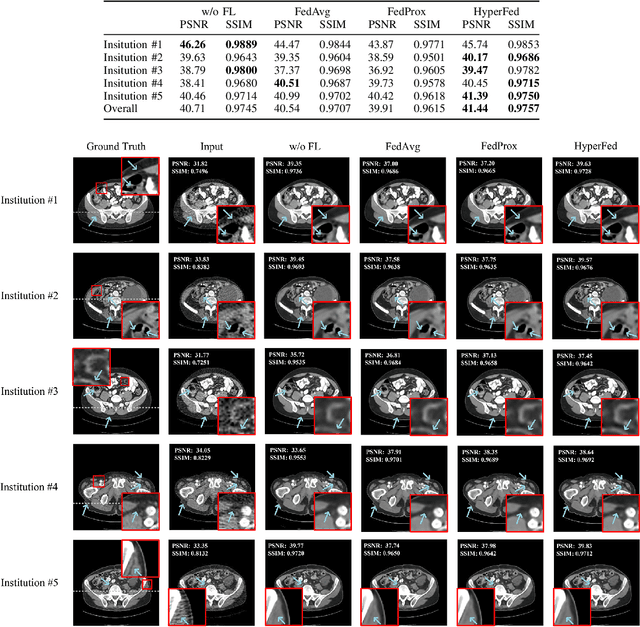 Figure 2 for Hypernetwork-based Personalized Federated Learning for Multi-Institutional CT Imaging