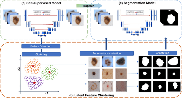 Figure 1 for Self-supervised Assisted Active Learning for Skin Lesion Segmentation