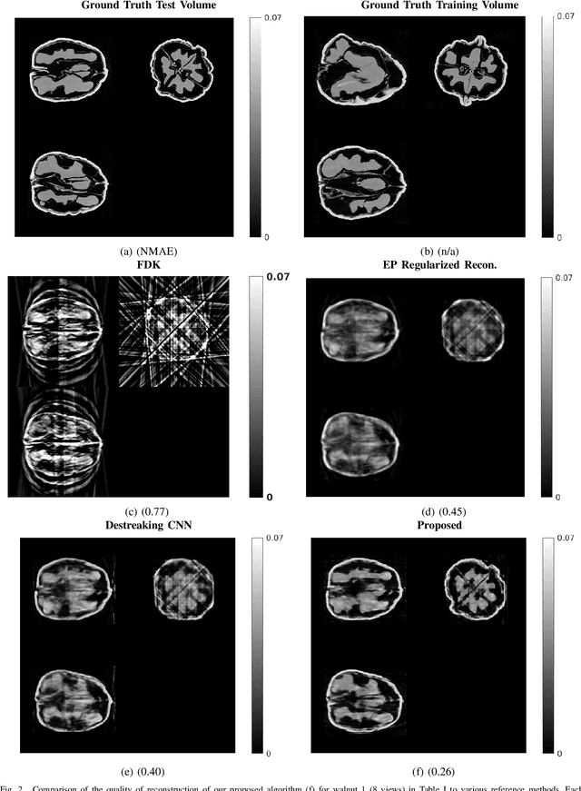 Figure 2 for Sparse-view Cone Beam CT Reconstruction using Data-consistent Supervised and Adversarial Learning from Scarce Training Data