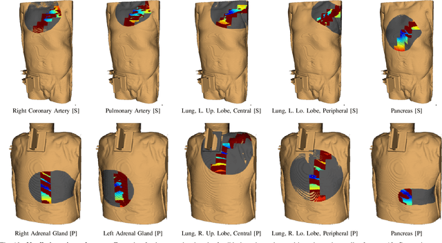 Figure 2 for Robotic Tissue Sampling for Safe Post-mortem Biopsy in Infectious Corpses