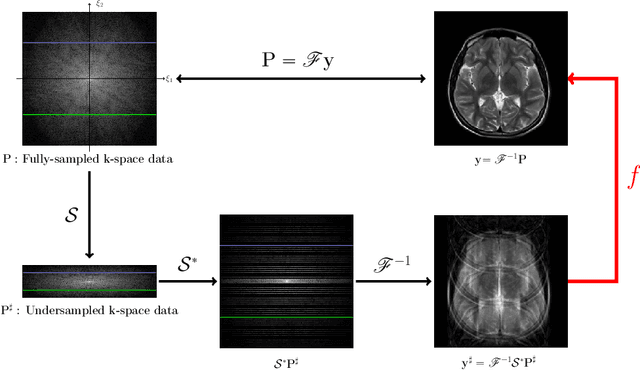 Figure 1 for Framelet Pooling Aided Deep Learning Network : The Method to Process High Dimensional Medical Data