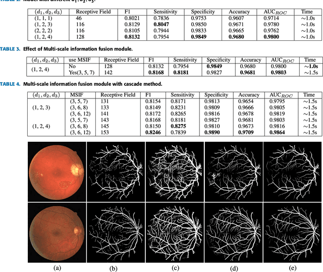 Figure 4 for Retinal Vessels Segmentation Based on Dilated Multi-Scale Convolutional Neural Network