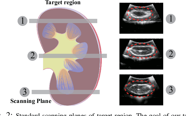 Figure 2 for Learning Robotic Ultrasound Scanning Skills via Human Demonstrations and Guided Explorations