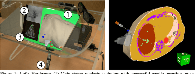 Figure 1 for Interpatient Respiratory Motion Model Transfer for Virtual Reality Simulations of Liver Punctures