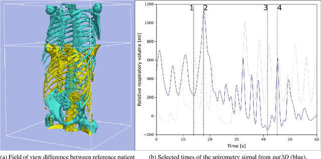 Figure 2 for Interpatient Respiratory Motion Model Transfer for Virtual Reality Simulations of Liver Punctures