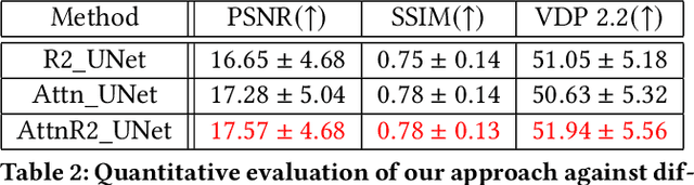 Figure 4 for HDR-cGAN: Single LDR to HDR Image Translation using Conditional GAN