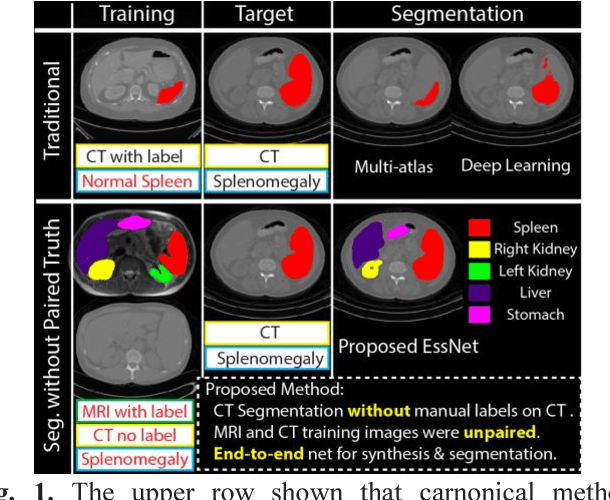 Figure 1 for Adversarial Synthesis Learning Enables Segmentation Without Target Modality Ground Truth